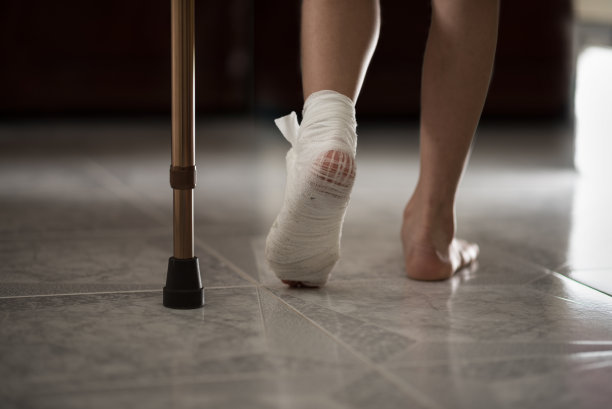 cast