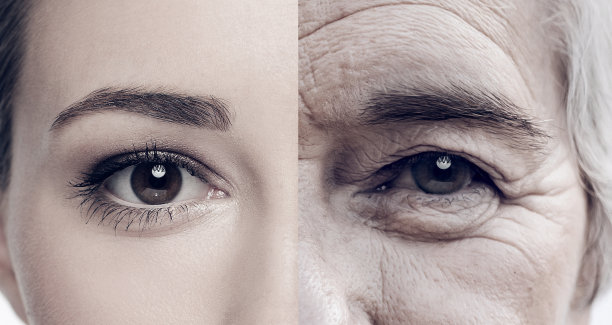 aged