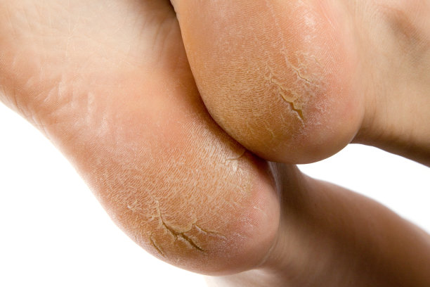 feet