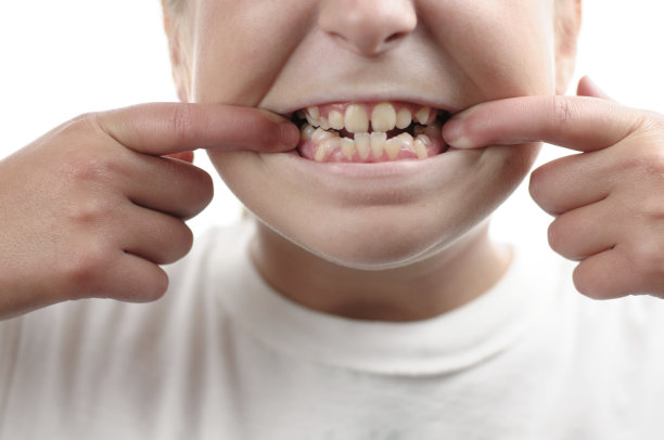 teeth
