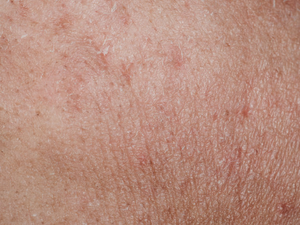 skin