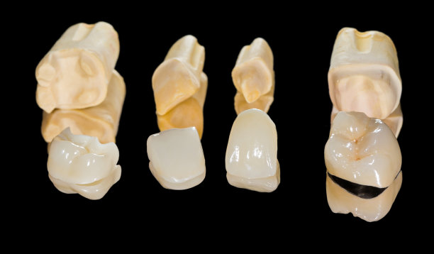 cast