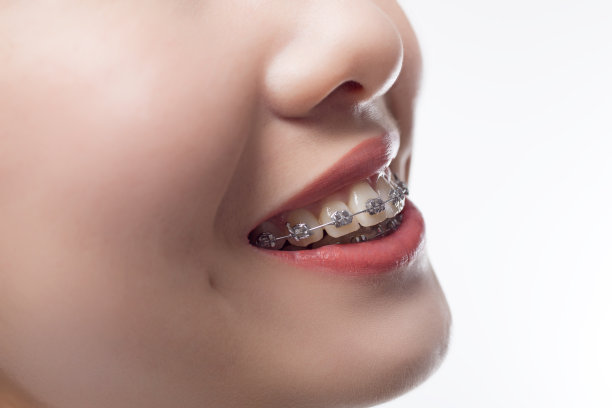 brace
