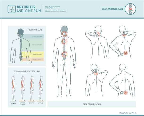 arthritis
