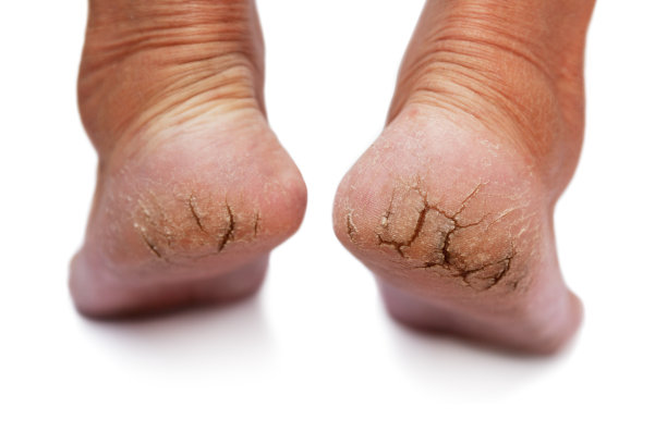 feet