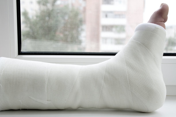 cast