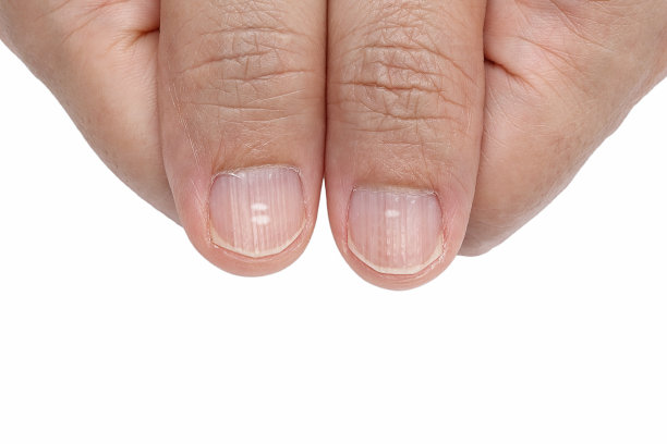 nail