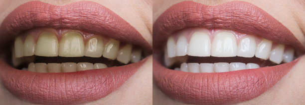 teeth
