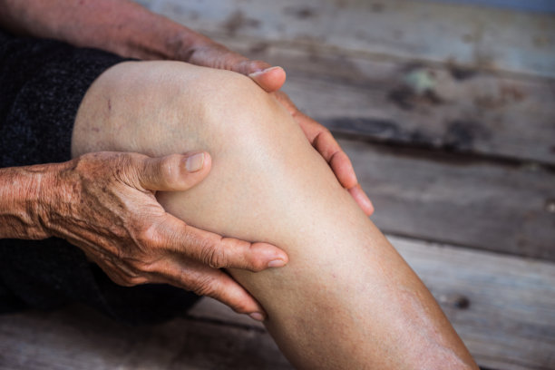 arthritis