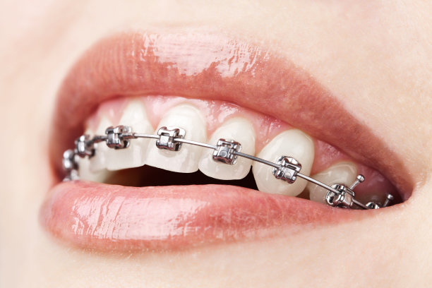 brace