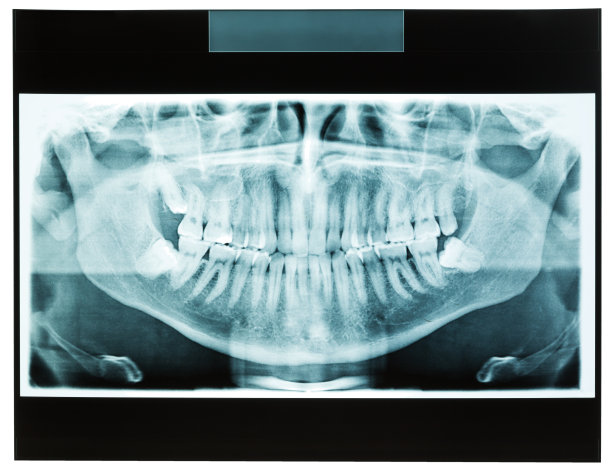 牙齿x光片