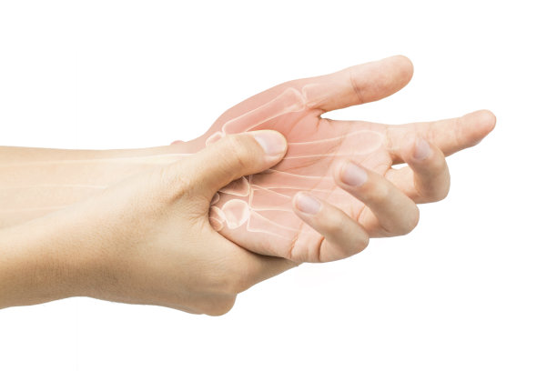 arthritis