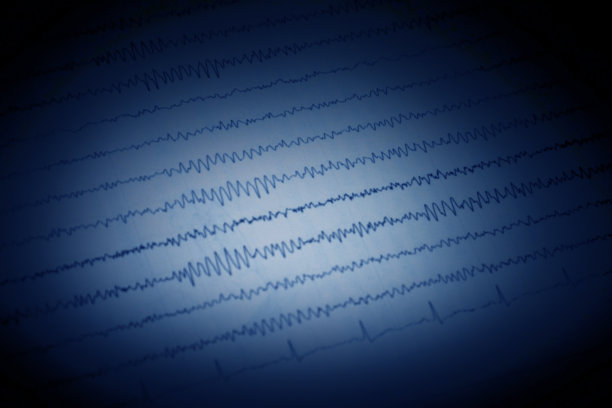 eeg