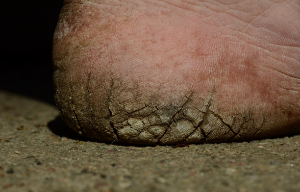 feet