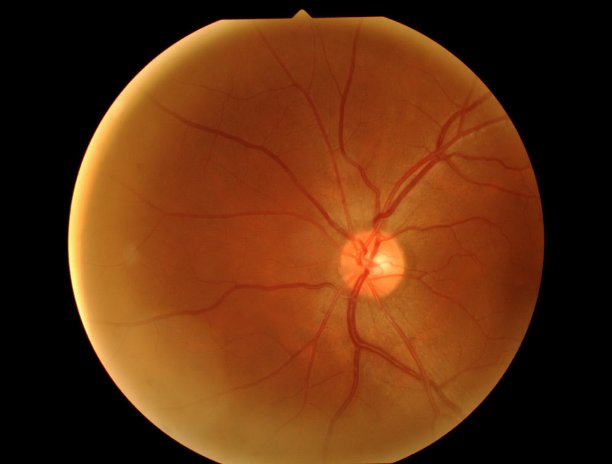 retina