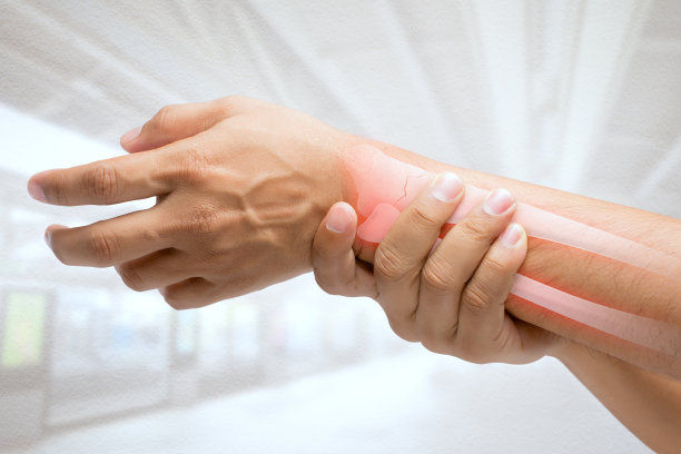 arthritis