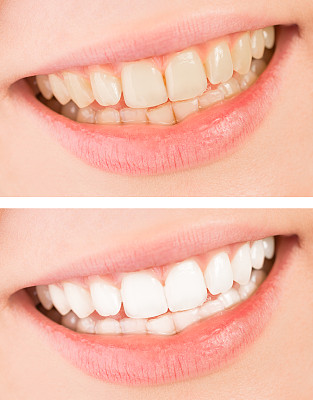teeth