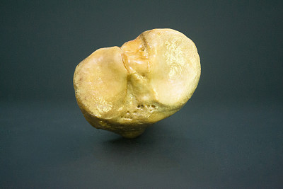 tibia