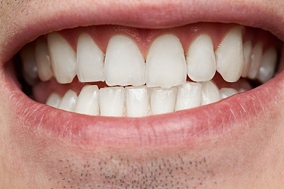 teeth