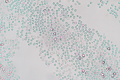 酵母细胞