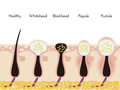 pores