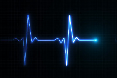 ekg