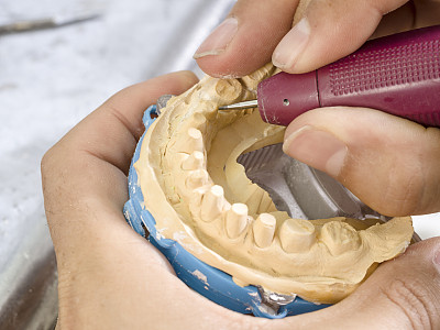 牙齿保健专业种牙
