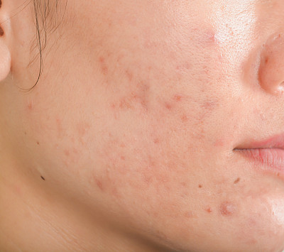 skin
