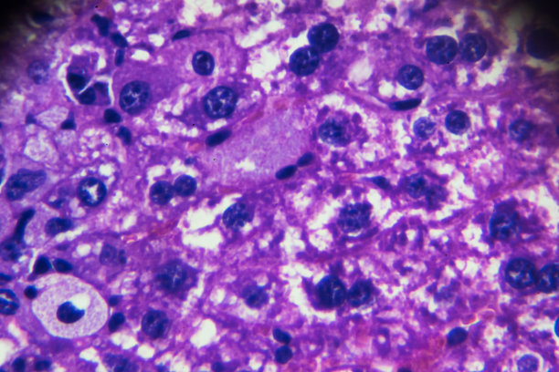 病原图片素材 病原设计素材 病原摄影作品 病原源文件下载 病原图片素材下载 病原背景素材 病原模板下载 搜索中心