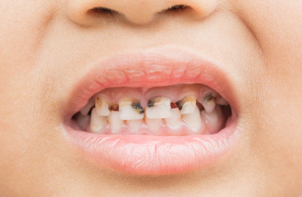 teeth
