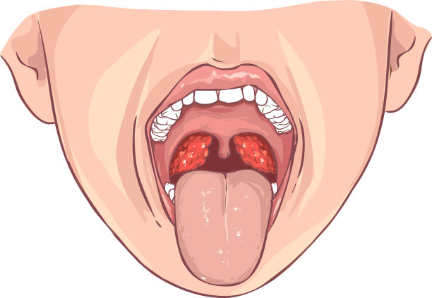 inflammation