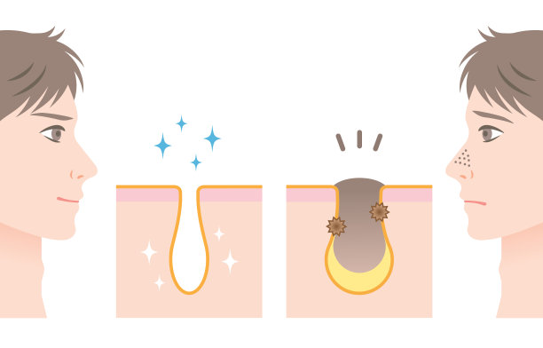 pores