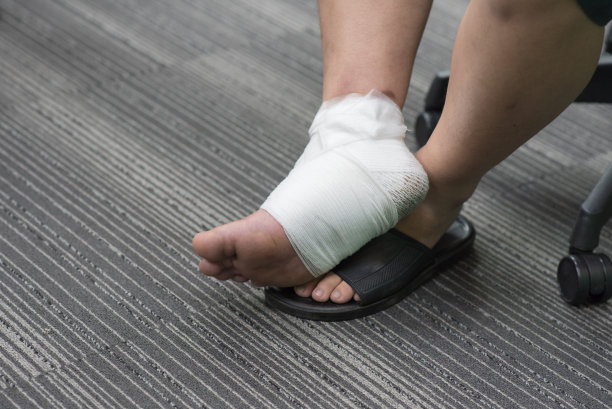 cast