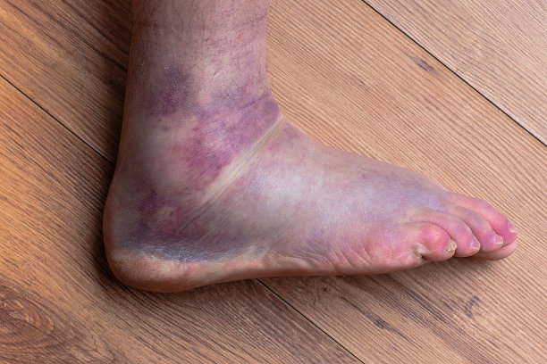 feet