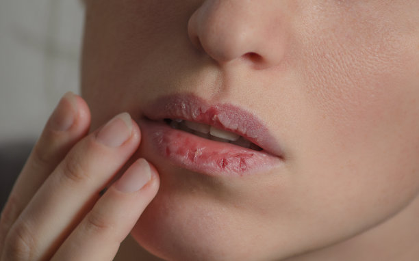 lip