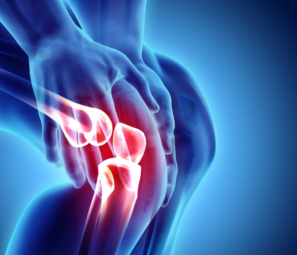 arthritis