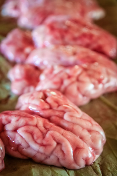 brain