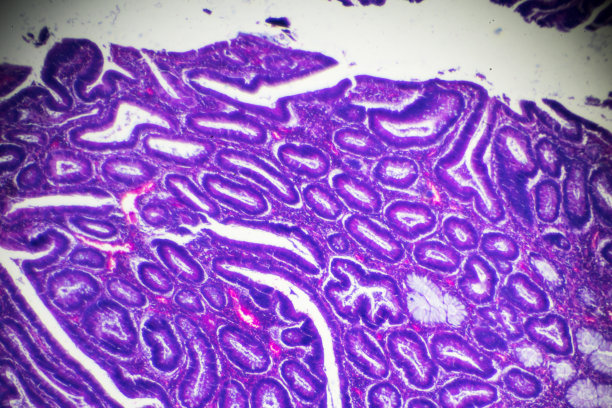 粘膜下层图片素材 粘膜下层设计素材 粘膜下层摄影作品 粘膜下层源文件下载 粘膜下层图片素材下载 粘膜下层背景素材 粘膜下层模板下载 搜索中心