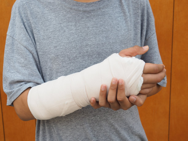 cast