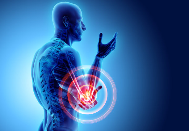 arthritis