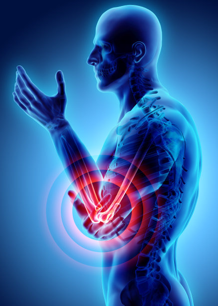 arthritis