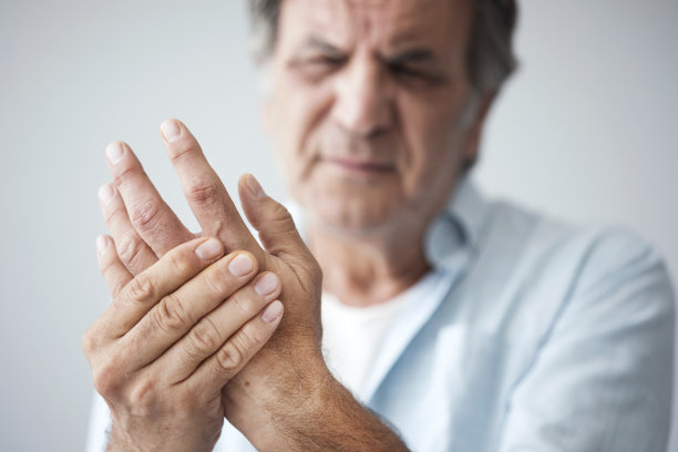 arthritis