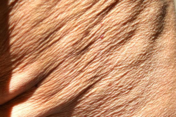 wrinkles
