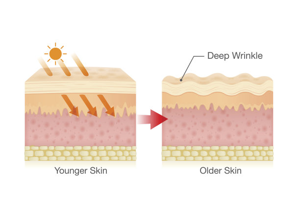 skin