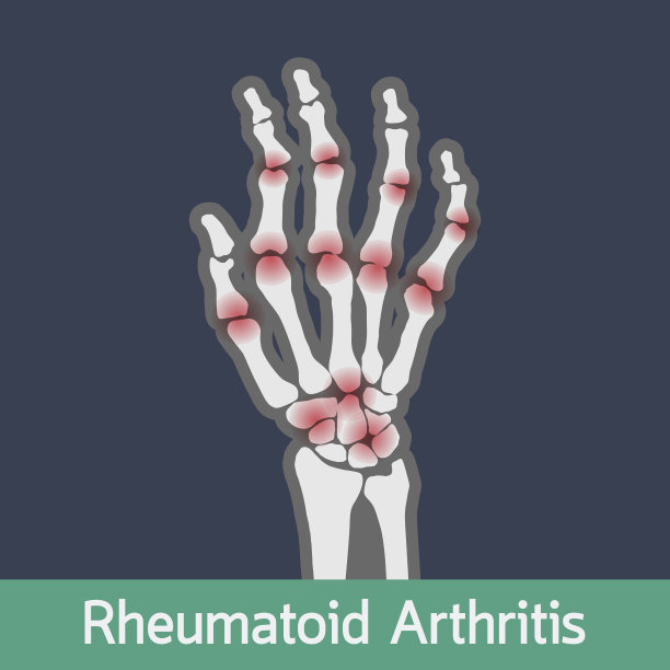 arthritis