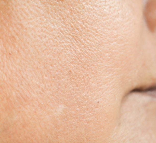 pores