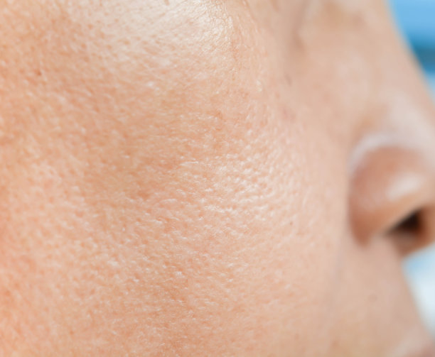 pores