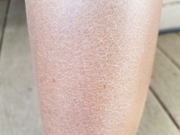 legs