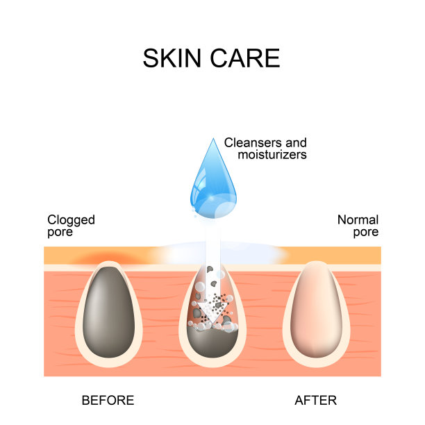 pores