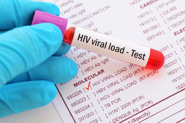 hiv
